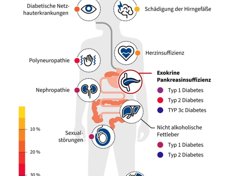 Unterschätzte Gefahr bei Diabetes mellitus: Unterzuckerungen durch Verdauungsenzymmangel - Foto: presseportal.de