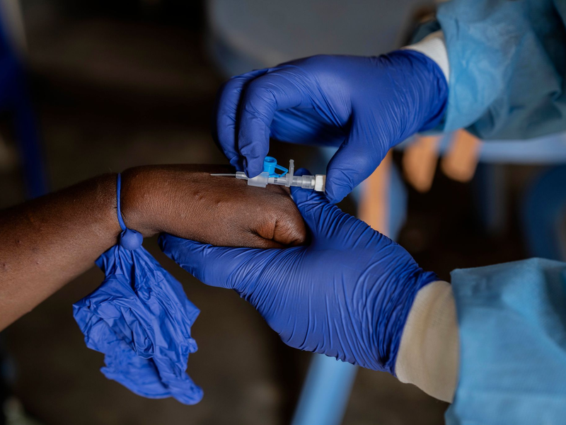 Die Zahl der Mpox-Fälle nimmt in mehreren afrikanischen Ländern weiter zu (Archivbild). - Foto: Moses Sawasawa/AP/dpa