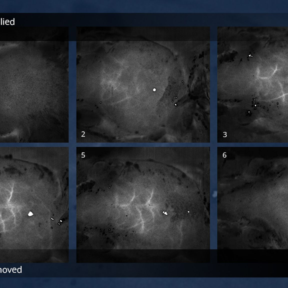 Mit schlichter Lebensmittelfarbe lässt sich Haut transparent machen - wohl auch bei Menschen. - Foto: Gail Rupert/NSF/Stanford University/dpa