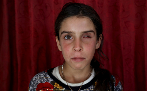 Fast die Hälfte aller gemeldeten Streumunitionsopfer im Vorjahr waren Kinder. (Archivbild) - Foto: Omar Albam/AP Fast die Hälfte aller gemeldeten Streumunitionsopfer im Vorjahr waren Kinder. (Archivbild) - Foto: Omar Albam/AP