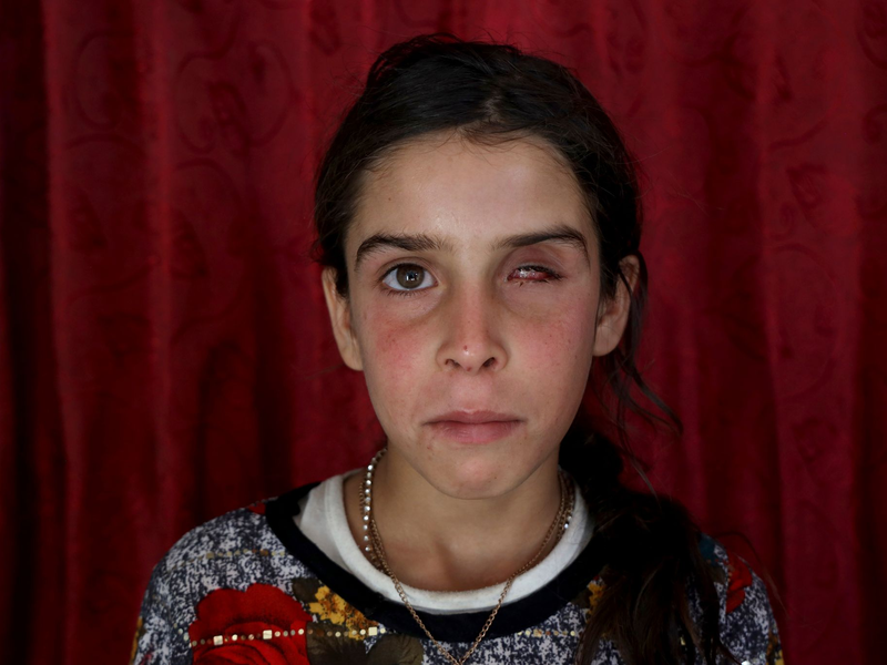 Fast die Hälfte aller gemeldeten Streumunitionsopfer im Vorjahr waren Kinder. (Archivbild) - Foto: Omar Albam/AP