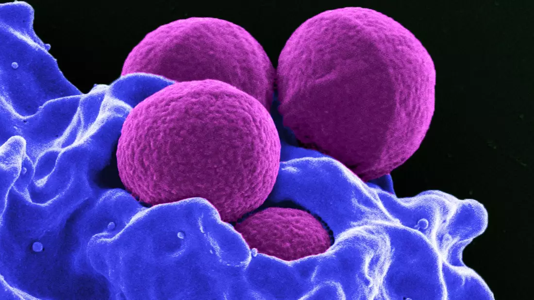 Jede Anwendung kann zur Vermehrung resistenter Bakterien führen, da diese dann einen Überlebensvorteil haben. (Archivbild) - Bild: -/National Institute of Allergy and Infectious Diseases (NIAID)/dpa