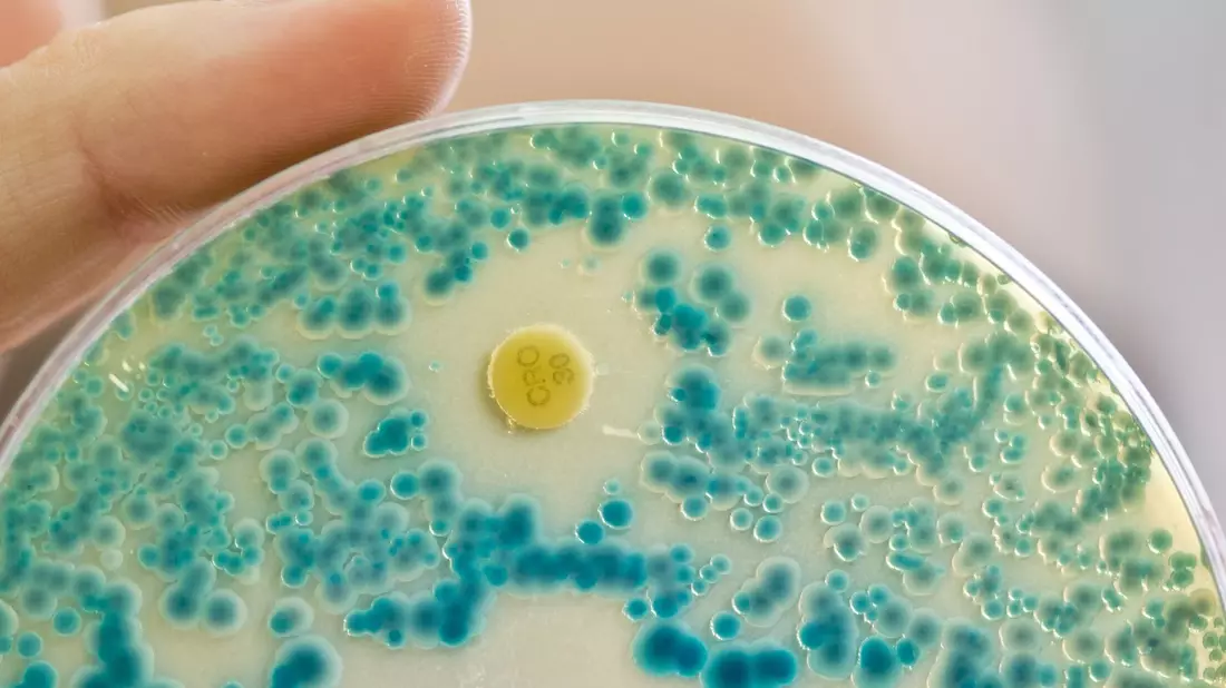 Indikatorkulturplatte zum Nachweis von resistenten Bakterien: Antibiotikaresistente Keime verursachen allein in der EU jährlich Zehntausende Todesfälle. (Symbolbild) - Bild: Daniel Karmann/dpa