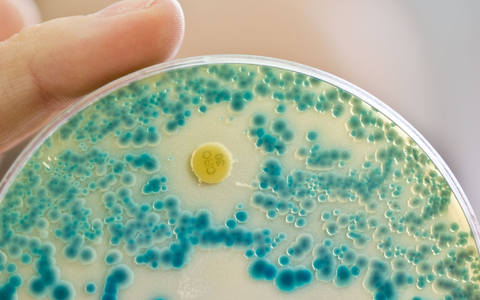 Indikatorkulturplatte zum Nachweis von resistenten Bakterien: Antibiotikaresistente Keime verursachen allein in der EU jÀhrlich Zehntausende TodesfÀlle. (Symbolbild) - Foto: Daniel Karmann/dpa Indikatorkulturplatte zum Nachweis von resistenten Bakterien: Antibiotikaresistente Keime verursachen allein in der EU jÀhrlich Zehntausende TodesfÀlle. (Symbolbild) - Foto: Daniel Karmann/dpa