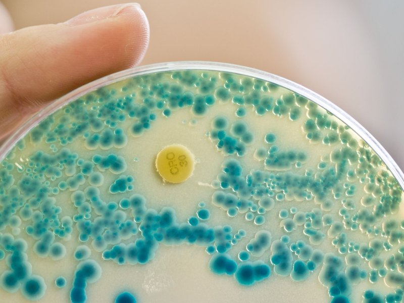 Indikatorkulturplatte zum Nachweis von resistenten Bakterien: Antibiotikaresistente Keime verursachen allein in der EU jährlich Zehntausende Todesfälle. (Symbolbild) - Foto: Daniel Karmann/dpa