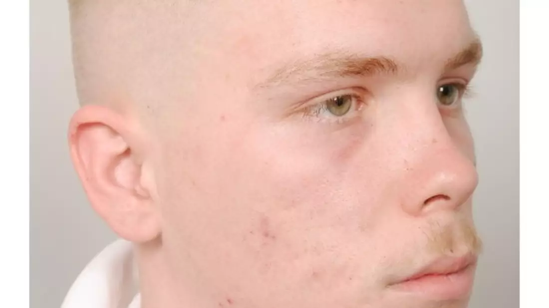 POL-H: Öffentlichkeitsfahndung: Polizei Hannover sucht mit Haftbefehl nach Joshua D. - Bild: presseportal.de