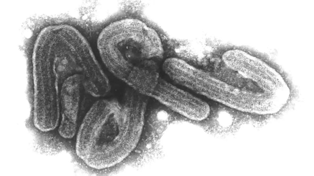 Eine elektronenmikroskopische Aufnahme des Marburg-Virus. - Bild: Bernhard-Nocht-Institut/dpa
