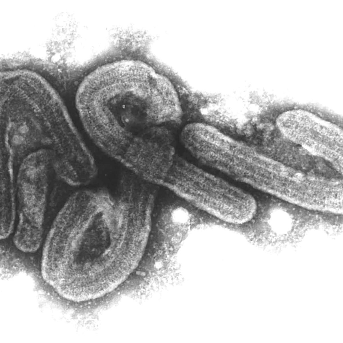Es bleibt beim einzigen Fall in Deutschland im Jahr 1967. - Foto: Bernhard-Nocht-Institut/dpa