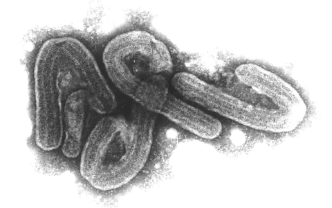 Elektronenmikroskopische Aufnahme des Marburg-Virus. Das Marburg-Virus gehört zu den gefährlichsten bekannten Krankheitserregern. - Foto: Bernhard-Nocht-Institut/dpa