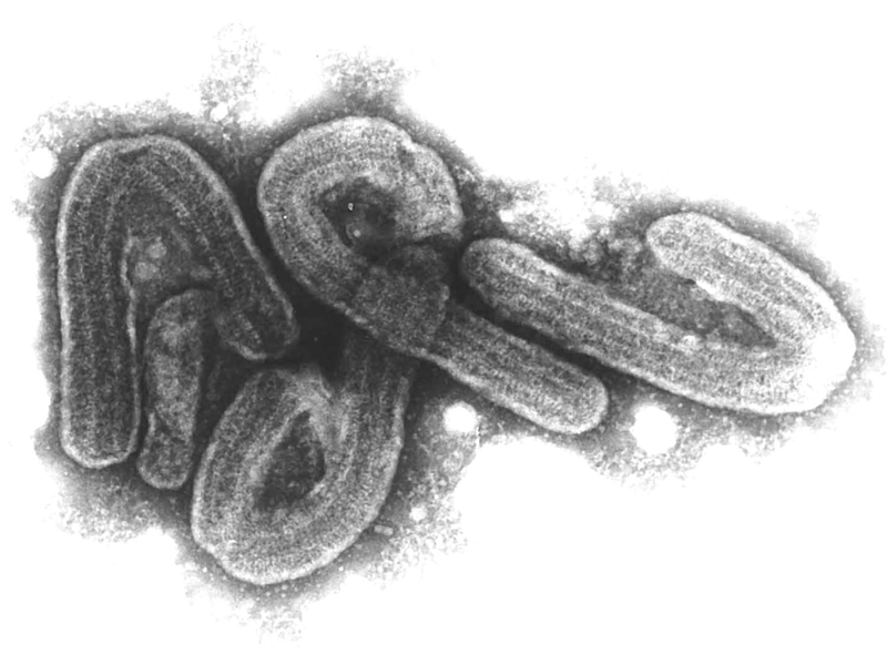 Eine elektronenmikroskopische Aufnahme des Marburg-Virus. (Archivbild) - Foto: Bernhard-Nocht-Institut/dpa