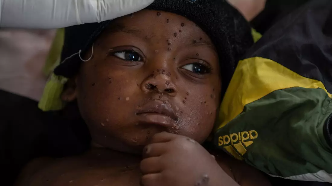 Ein besorgniserregendes Risiko sehen die beiden Experten für Übertragungen zwischen Kindern. (Archivbild) - Bild: Moses Sawasawa/AP/dpa