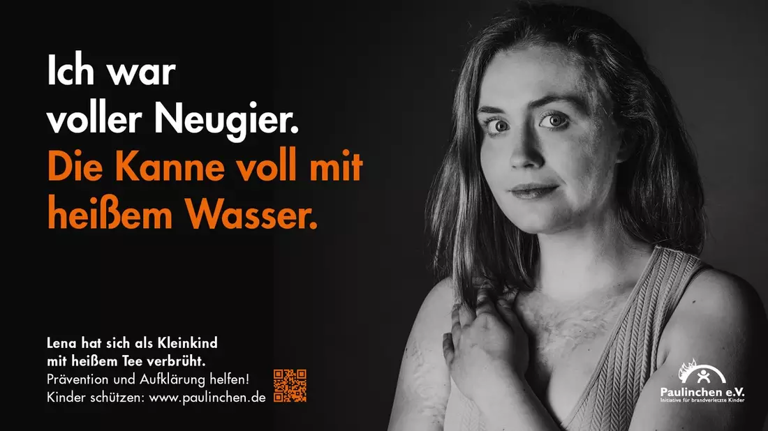 Tag des brandverletzten Kindes am 7. Dezember: Paulinchen e.V. warnt unter dem Motto Tee tut weh vor Gefahren durch heiße Flüssigkeiten - Bild: presseportal.de
