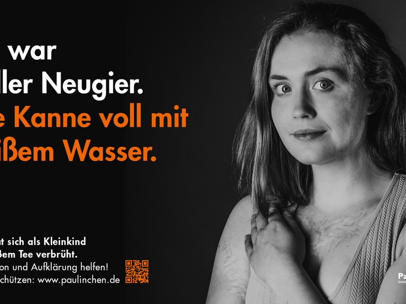 Tag des brandverletzten Kindes am 7. Dezember: Paulinchen e.V. warnt unter dem Motto Tee tut weh vor Gefahren durch heiße Flüssigkeiten - Foto: presseportal.de