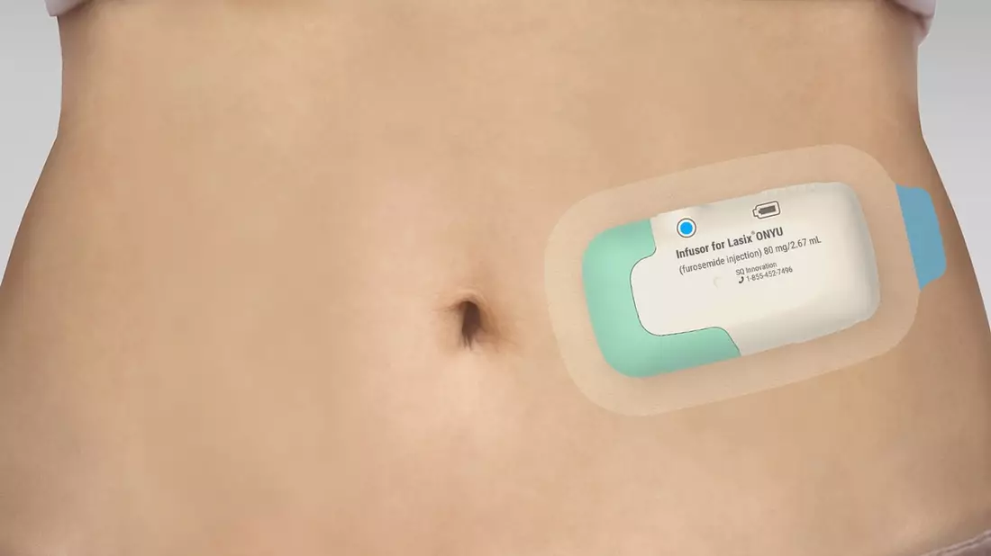 Gerresheimer: FDA erteilt Tentative Approval für Lasix von SQ Innovation® ONYU* - Bild: presseportal.de