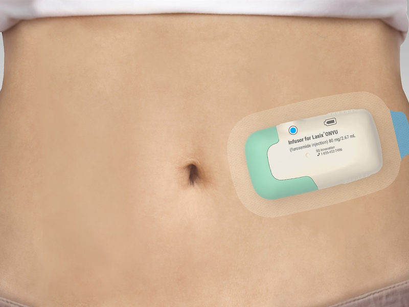 Gerresheimer: FDA erteilt Tentative Approval für Lasix von SQ Innovation® ONYU* - Foto: presseportal.de