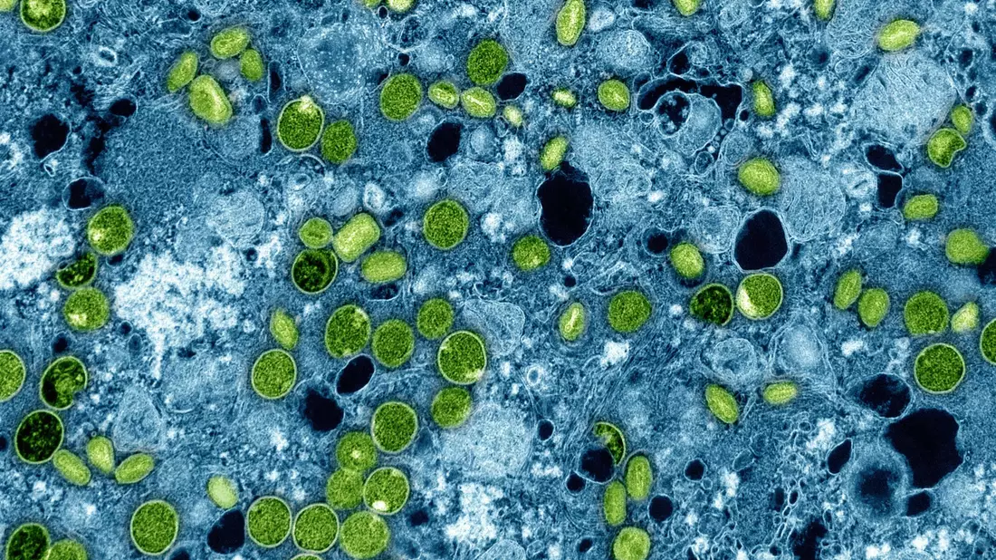 Diese kolorierte elektronenmikroskopische Aufnahme aus dem Jahr 2024 zeigt Mpox-Viruspartikel (grün). (Archivbild) - Bild: -/NIAID via AP/dpa