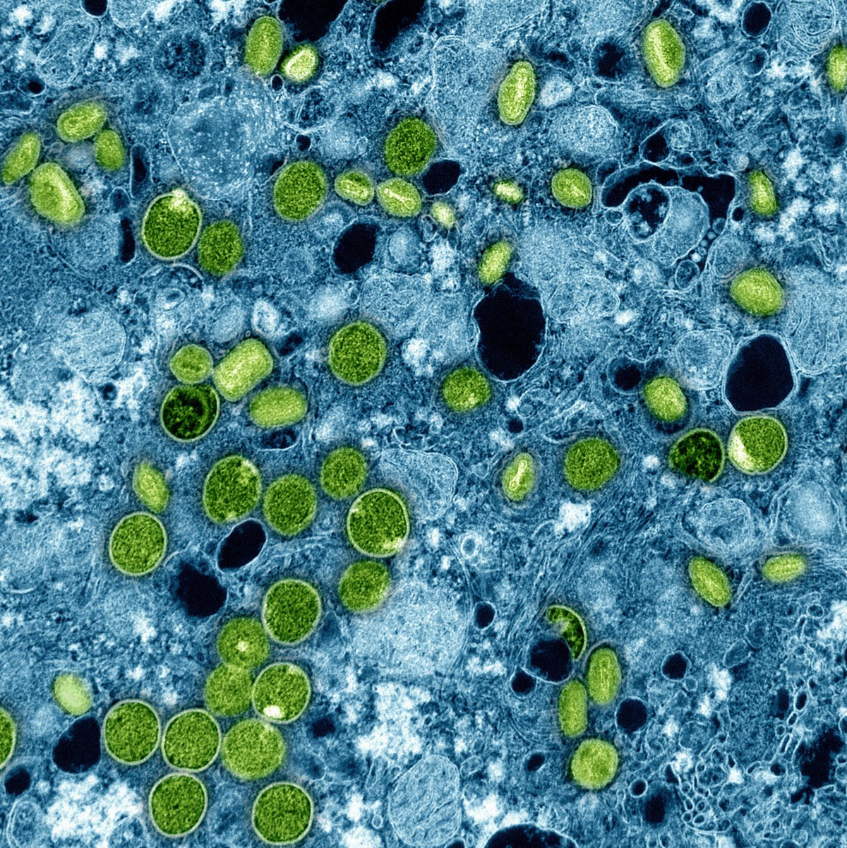 Diese kolorierte elektronenmikroskopische Aufnahme aus dem Jahr 2024 zeigt Mpox-Viruspartikel (grün). (Archivbild) - Foto: -/NIAID via AP/dpa