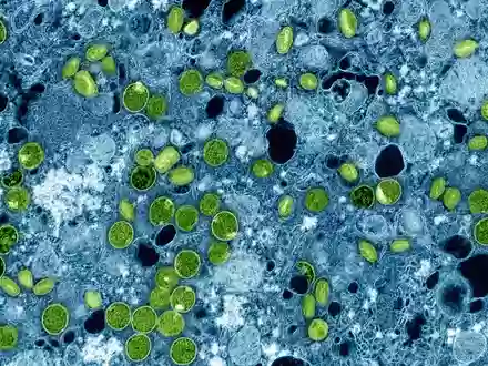 Diese kolorierte elektronenmikroskopische Aufnahme aus dem Jahr 2024 zeigt Mpox-Viruspartikel (grün). (Archivbild) - Foto: -/NIAID via AP/dpa