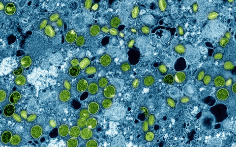 Diese kolorierte elektronenmikroskopische Aufnahme aus dem Jahr 2024 zeigt Mpox-Viruspartikel (grün). (Archivbild) - Foto: -/NIAID via AP/dpa