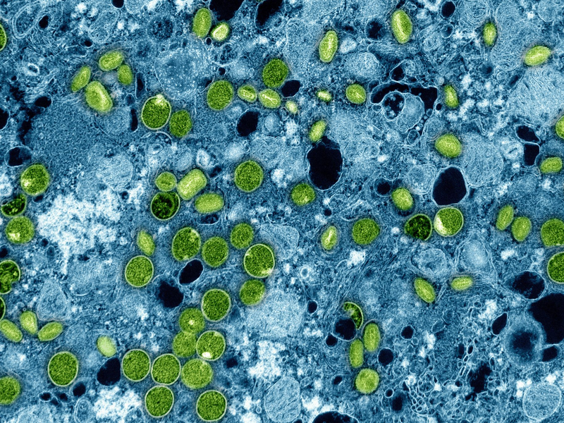 Diese kolorierte elektronenmikroskopische Aufnahme aus dem Jahr 2024 zeigt Mpox-Viruspartikel (grün). (Archivbild) - Foto: -/NIAID via AP/dpa