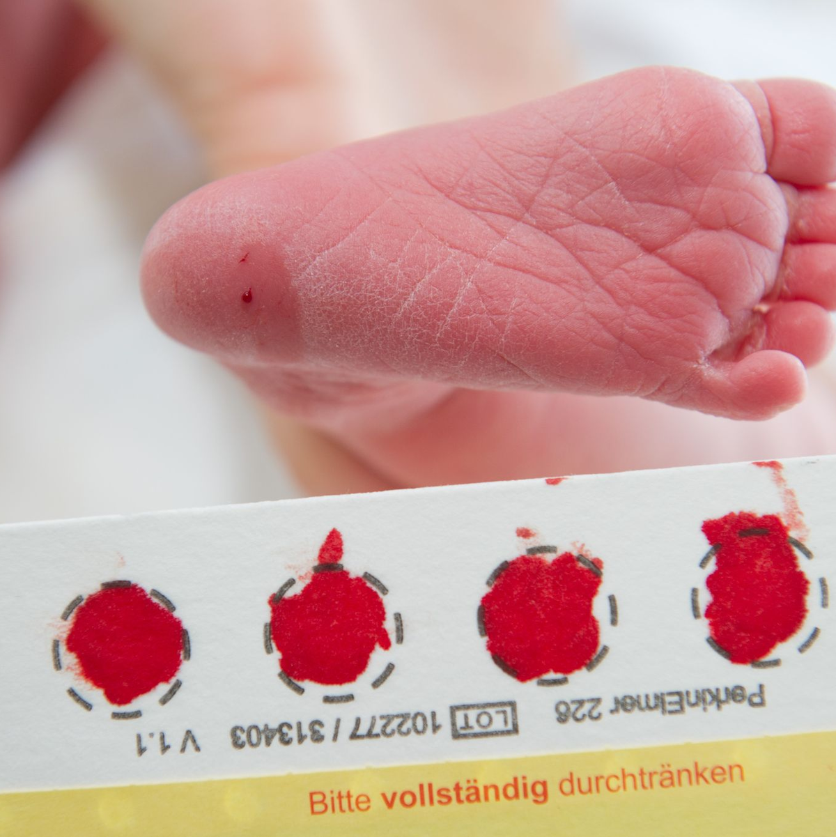 Ein Bluttropfen vom Fuß eines Babys genügt, um viele Krankheit zu erkennen. (Archivbild) - Foto: picture alliance / Stefan Sauer/dpa-Zentralbild/dpa