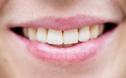 Alle Affen können lachen - aber unter allen Primaten haben nur Menschen eine Sprache herausgebildet. - Foto: picture alliance / dpa