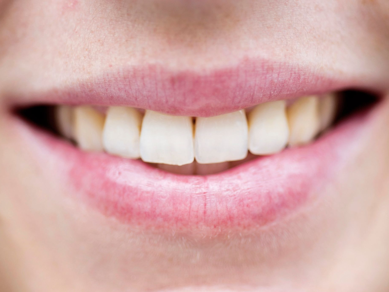 Alle Affen können lachen - aber unter allen Primaten haben nur Menschen eine Sprache herausgebildet. - Foto: picture alliance / dpa