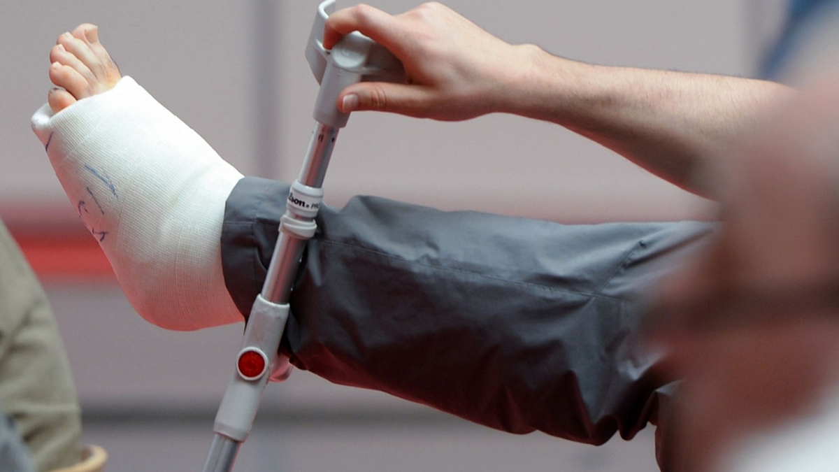 Ist Arbeiten mit gebrochenem Bein möglich? (Symbolbild) - Foto: picture alliance / dpa