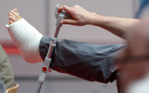 Ist Arbeiten mit gebrochenem Bein möglich? (Symbolbild) - Foto: picture alliance / dpa Ist Arbeiten mit gebrochenem Bein möglich? (Symbolbild) - Foto: picture alliance / dpa