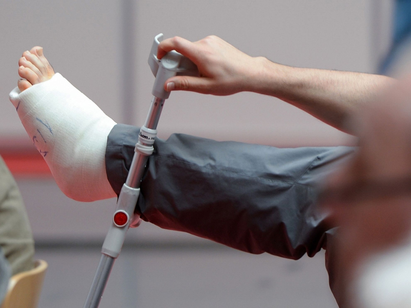 Ist Arbeiten mit gebrochenem Bein möglich? (Symbolbild) - Foto: picture alliance / dpa