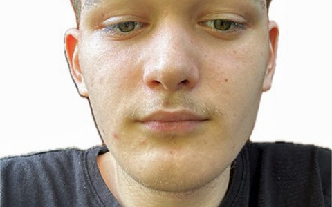 POL-LM: 16-Jähriger aus Bad Camberg vermisst - Foto: presseportal.de
