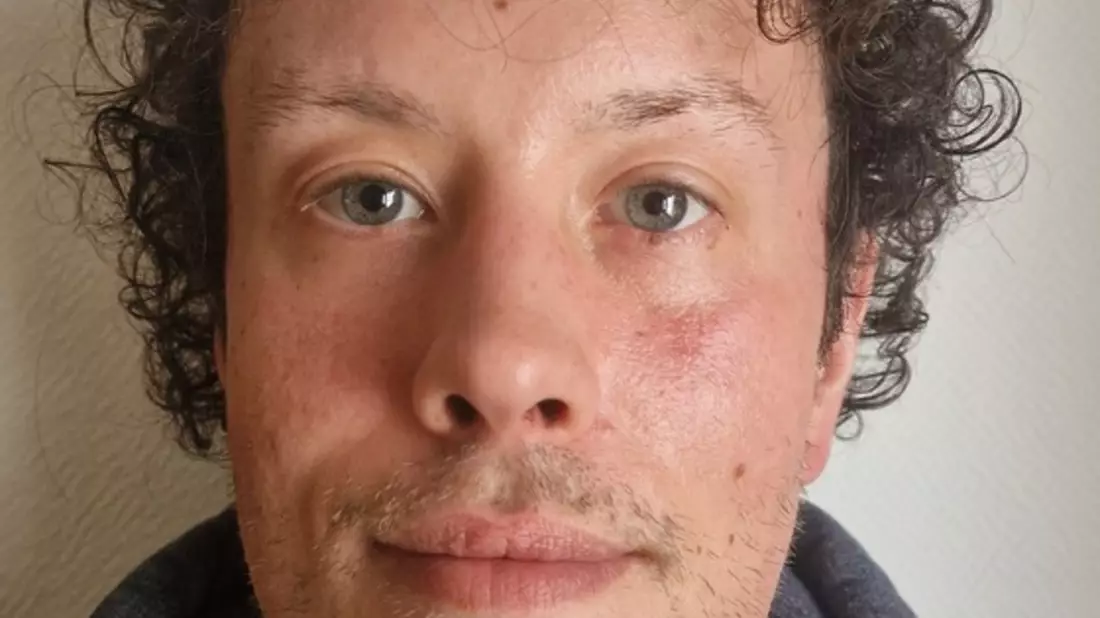 POL-GÖ: (33/2025) 37 Jahre alter Adrian W. aus Bad Sachsa seit Mittwoch vermisst - Bild: presseportal.de