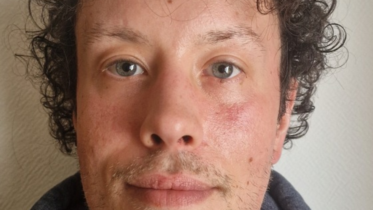 POL-GÖ: (33/2025) 37 Jahre alter Adrian W. aus Bad Sachsa seit Mittwoch vermisst - Foto: presseportal.de