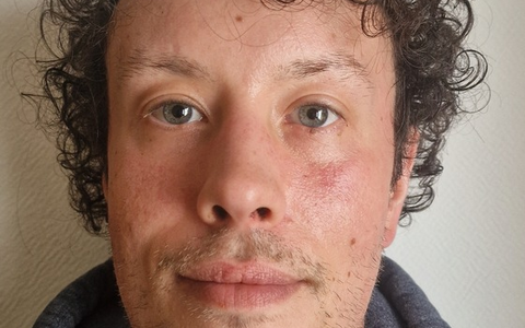 POL-GÖ: (33/2025) 37 Jahre alter Adrian W. aus Bad Sachsa seit Mittwoch vermisst - Foto: presseportal.de