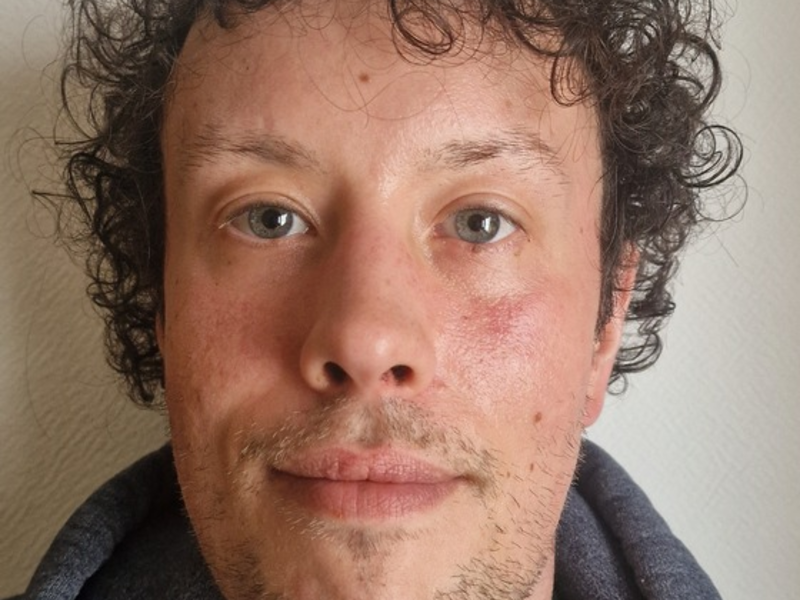 POL-GÖ: (33/2025) 37 Jahre alter Adrian W. aus Bad Sachsa seit Mittwoch vermisst - Foto: presseportal.de