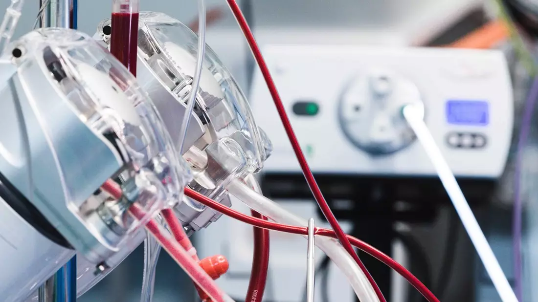 100.000ste Operation mit einer Herz-Lungen-Maschine am RHÖN-KLINIKUM Campus Bad Neustadt - Bild: presseportal.de