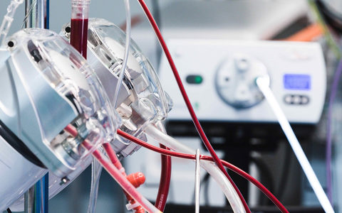 100.000ste Operation mit einer Herz-Lungen-Maschine am RHÖN-KLINIKUM Campus Bad Neustadt - Foto: presseportal.de 100.000ste Operation mit einer Herz-Lungen-Maschine am RHÖN-KLINIKUM Campus Bad Neustadt - Foto: presseportal.de