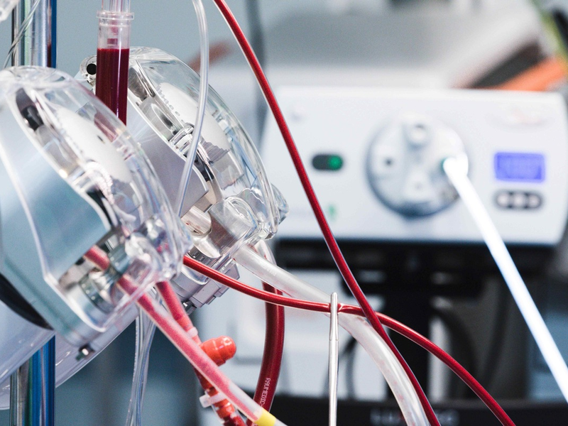 100.000ste Operation mit einer Herz-Lungen-Maschine am RHĂ–N-KLINIKUM Campus Bad Neustadt - Foto: presseportal.de