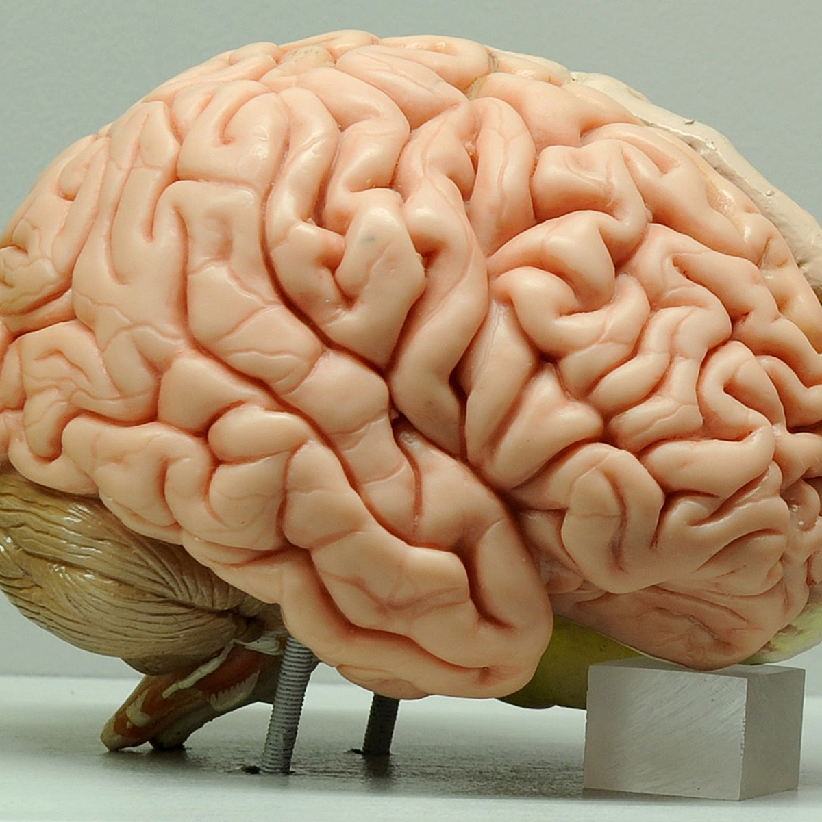 Auffällig hoch war die Plastikbelastung in den Gehirnen von Menschen mit Demenz - hier sei aber noch weitere Forschung nötig, so die Studie. (Symbolbild) - Foto: Ingo Wagner/dpa