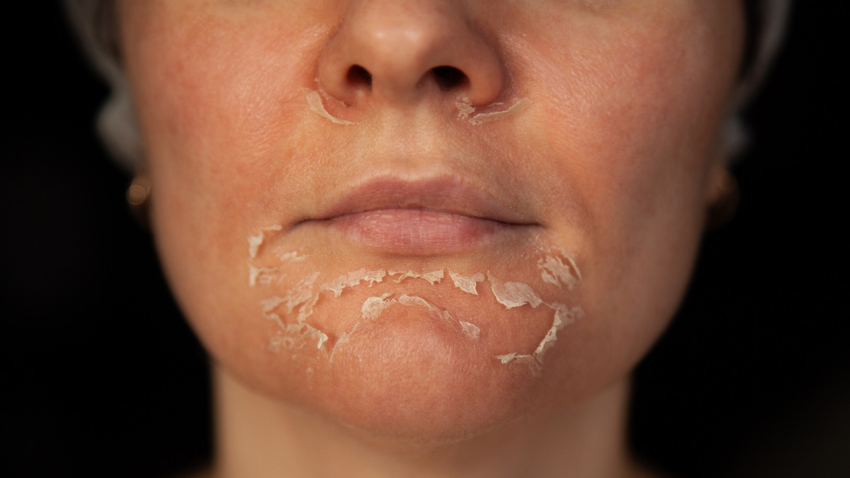 Evertz Pharma warnt: Kosmetik kann die Haut ruinieren! - Foto: presseportal.de