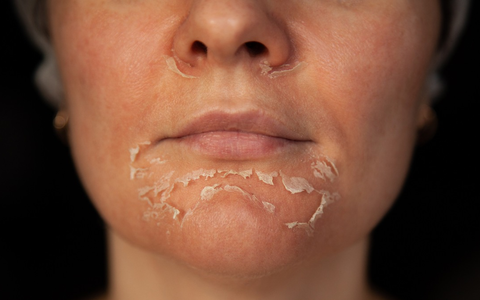 Evertz Pharma warnt: Kosmetik kann die Haut ruinieren! - Foto: presseportal.de