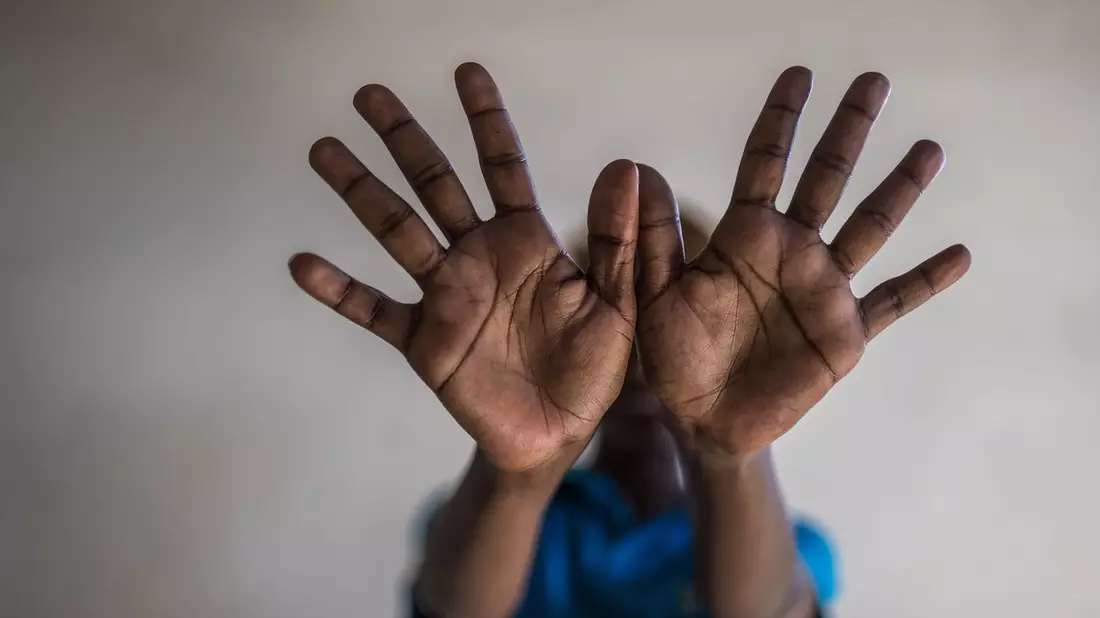 Horror für 450 Mädchen jede Stunde: Internationaler Tag gegen weibliche Genitalverstümmelung - Bild: presseportal.de