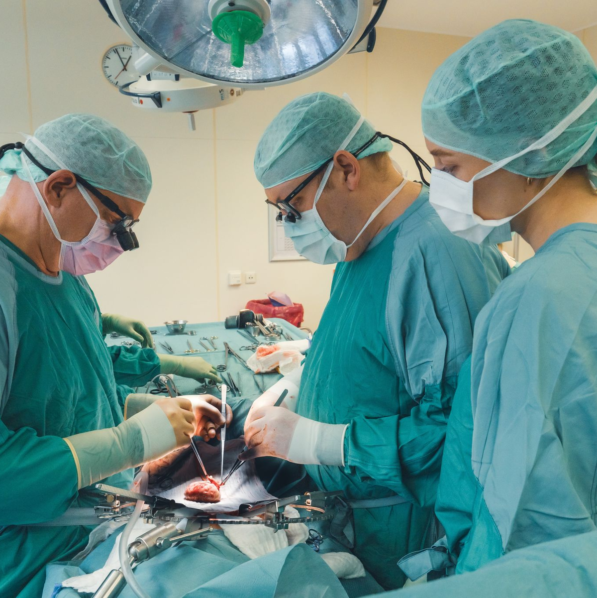 Philipp Felgendreff (mitte) transplantiert wie hier häufig menschliche Nieren, hat aber Hoffnung, dass er künftig auch Schweinenieren in Menschen einsetzt. - Foto: Anna-Katharina Junge/Medizinische Hochschule Hannover/dpa