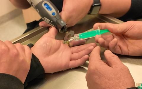 FW-OLL: Ring schnürt Finger ab - Feuerwehr entfernt Ring in der Notaufnahme - Foto: presseportal.de