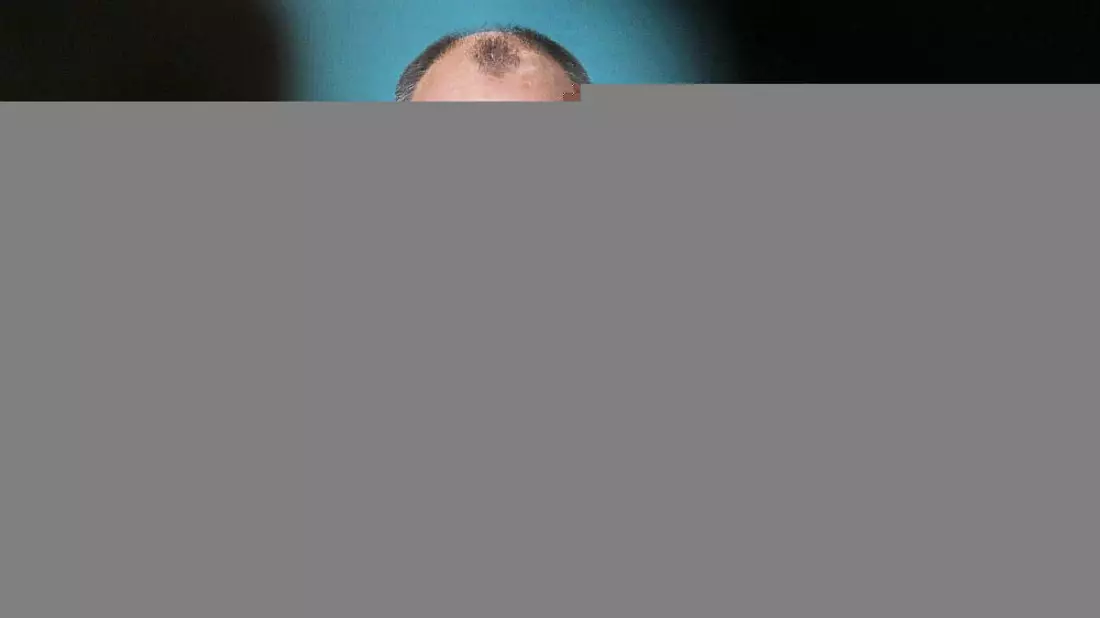 Friedrich Merz (Archiv) - Bild: über dts Nachrichtenagentur
