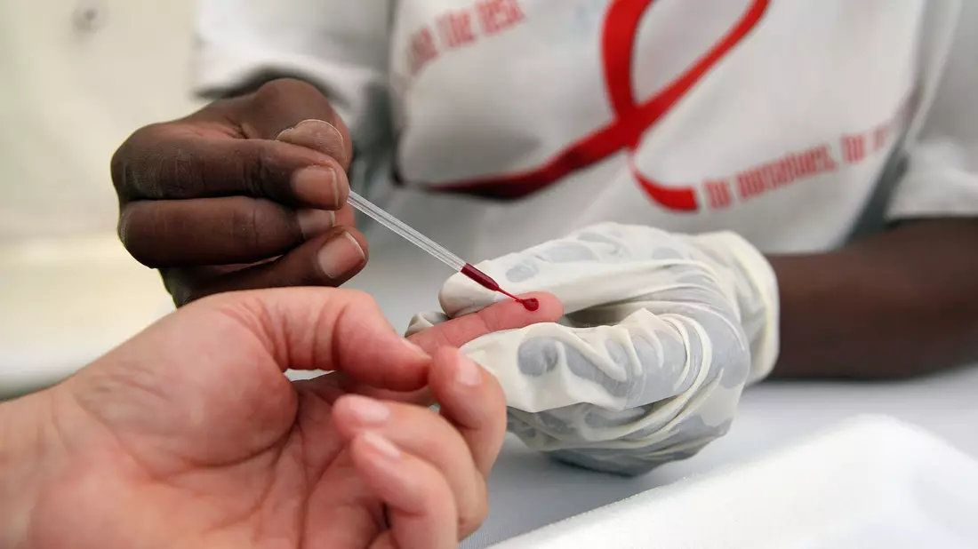 Blutabnahme für einen HIV-Test in einer südafrikanischen Klinik (Archivbild) - Bild: picture alliance / dpa