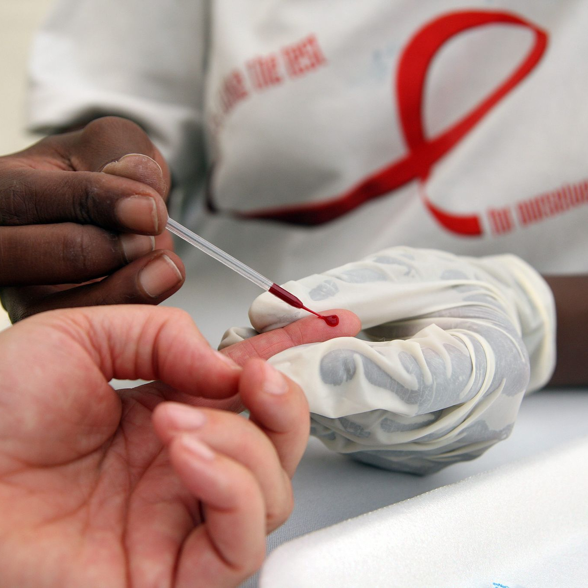 Blutabnahme für einen HIV-Test in einer südafrikanischen Klinik (Archivbild) - Foto: picture alliance / dpa