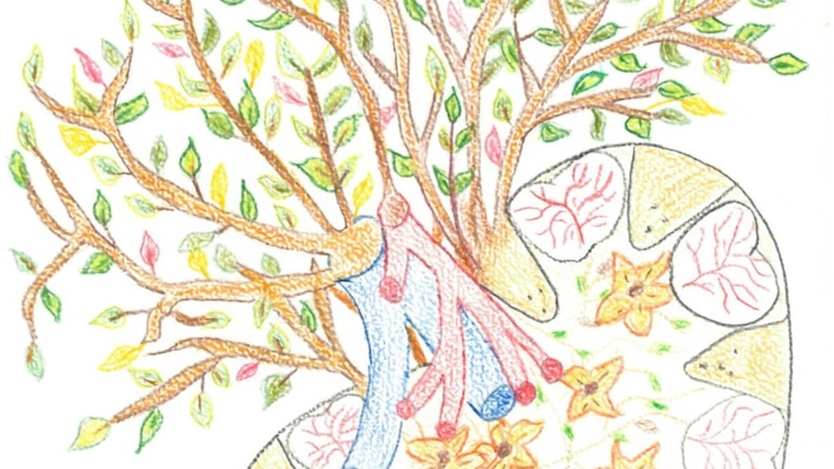 Weltnierentag am 13. März 2025 / Hoher Bedarf an Nierentransplantationen: Ein neues Organ ist für viele Betroffene wie ein geschenktes Leben - Foto: presseportal.de