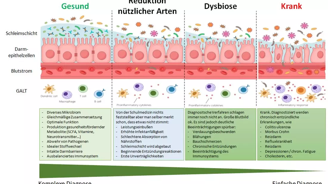 Leaky Gut - Bild: BonaFeel über pressetext.de