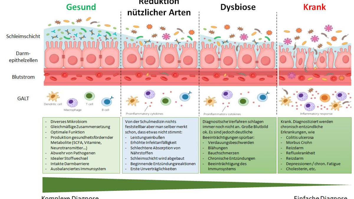 Leaky Gut - Foto: BonaFeel über pressetext.de